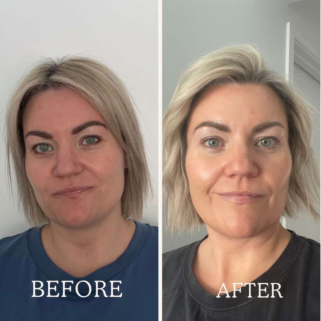 SKIN RESET KIT